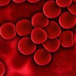 Todo lo que necesitas saber sobre qué es una sepsis